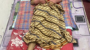 Mahasiswi Korban Kecelakaan Ranmor Hingga Cacat oleh Oknum Dokter diduga Tak Bertanggung Jawab, Pelaku Hanya Tersenyum Bagai Manusia Tanpa Dosa, Ayah Korban Minta APH Segerakan Proses Hukum